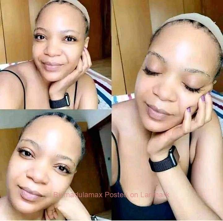Permanent skin lightening pills or injection in Polokwane+27 81 850 2816