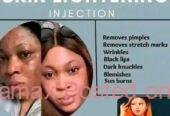 Permanent skin lightening pills or injection in Polokwane+27 81 850 2816