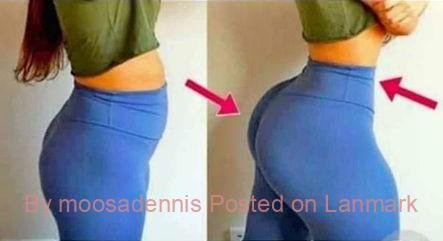 +27 74 676 7021 PMMA and Hydrogel Buttocks injections in South Africa, Lesotho, Eswatini
