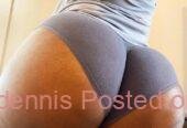 +27 74 676 7021 PMMA and Hydrogel Buttocks injections in South Africa, Lesotho, Eswatini