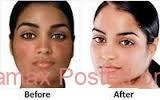 Kojic acid for skin lightening in Pietermaritzburg+27 81 850 2816