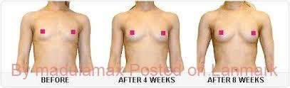 Nipples Enhancement Cream in Sandton+27 81 850 2816