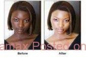 Permanent skin lightening pills or injection in Polokwane+27 81 850 2816